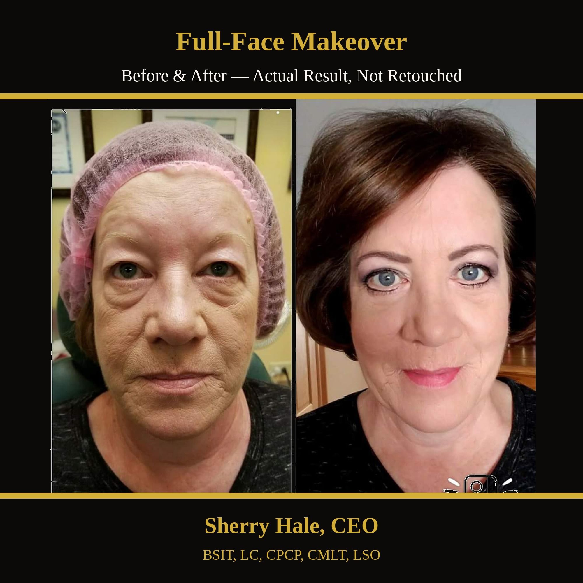 Full-face makeover — before & after